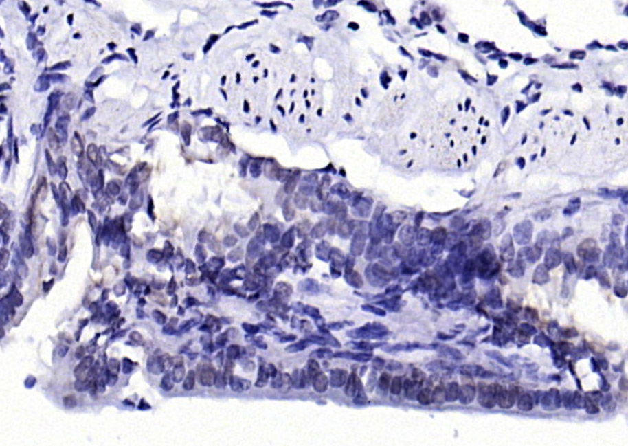 phospho-H2AX (Tyr143) Rabbit p