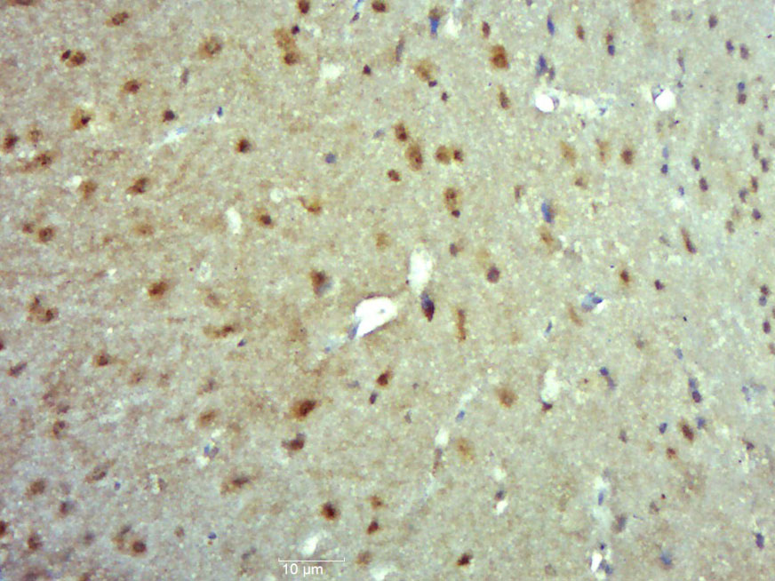 TRMT1 Rabbit pAb(bs-17142R)-50