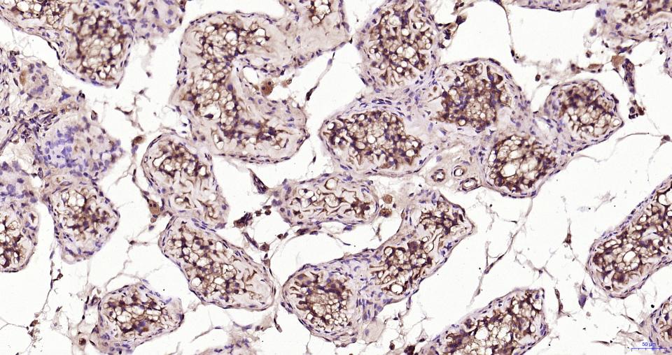 TBK1 Rabbit pAb(bs-7497R)-50ul