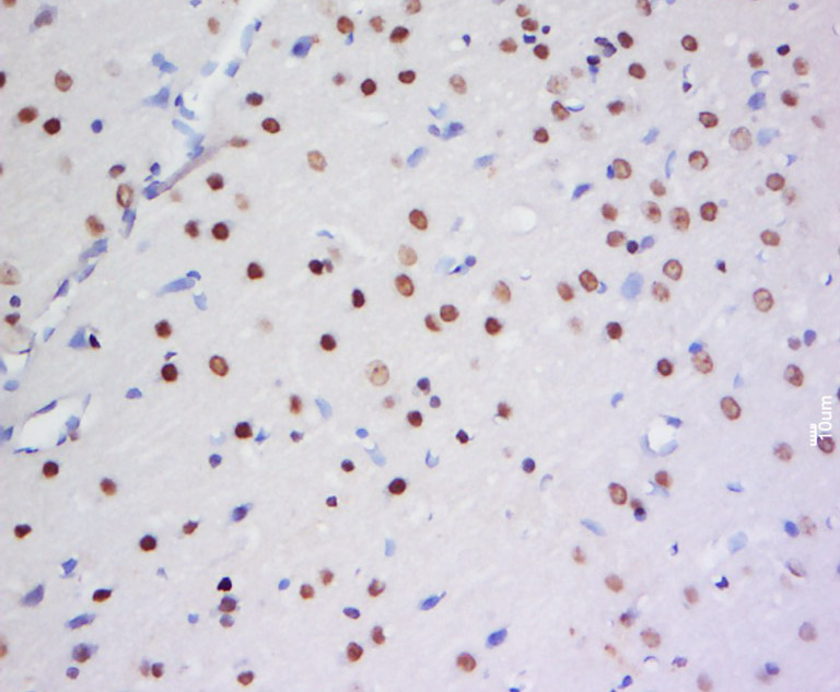 HSH2D Rabbit pAb(bs-13643R)-50