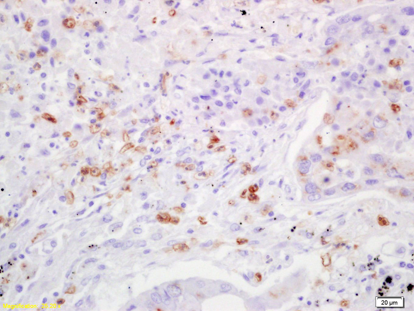 TIMP-3 Rabbit pAb(bs-0417R)-50