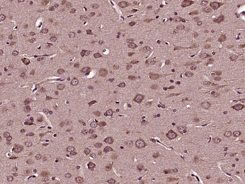 Angiotensin II type 1A recepto