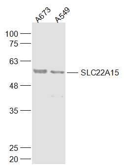 SLC22A15 Rabbit pAb(bs-21208R)
