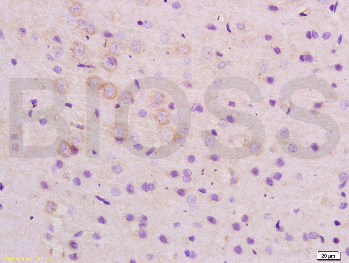 ARHGAP32 Rabbit pAb(bs-9296R)-