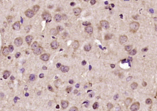 HCF2 Rabbit pAb(bs-9843R)-50ul