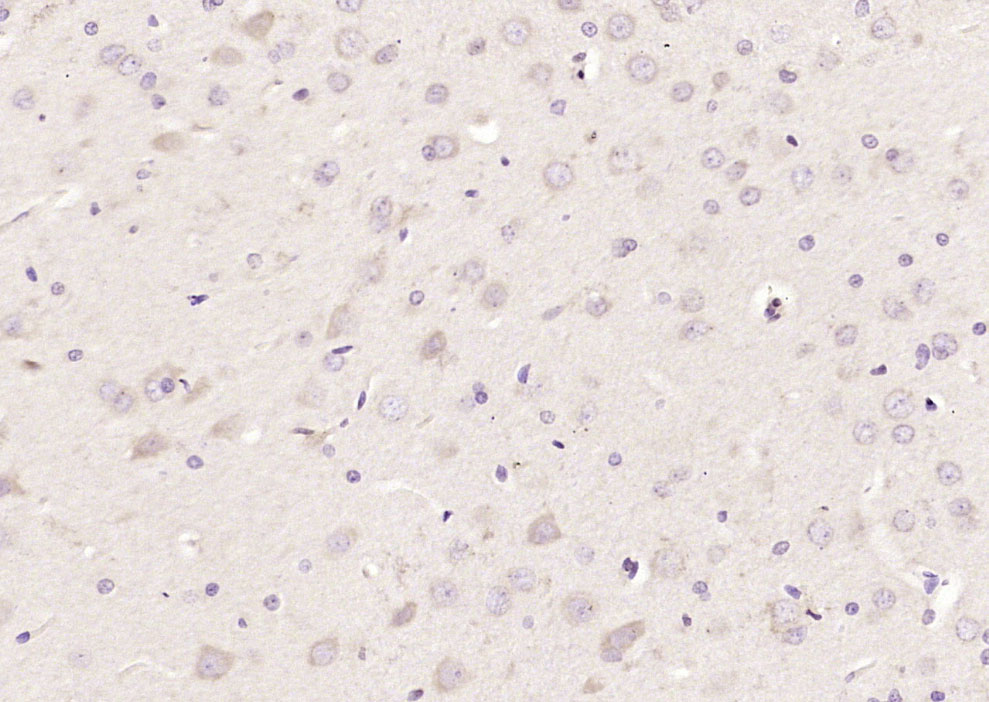 ANT1+ANT2+ANT3+ANT4 Rabbit pAb