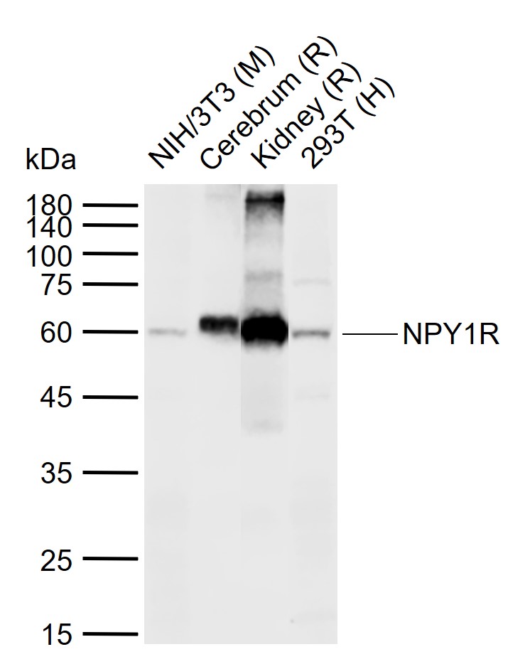 NPY1R Rabbit pAb(bs-1070R)-50u