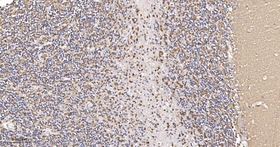 Synaptophysin Recombinant Rabb