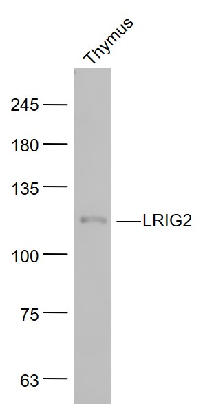 LRIG2 Rabbit pAb(bs-1845R)-50u
