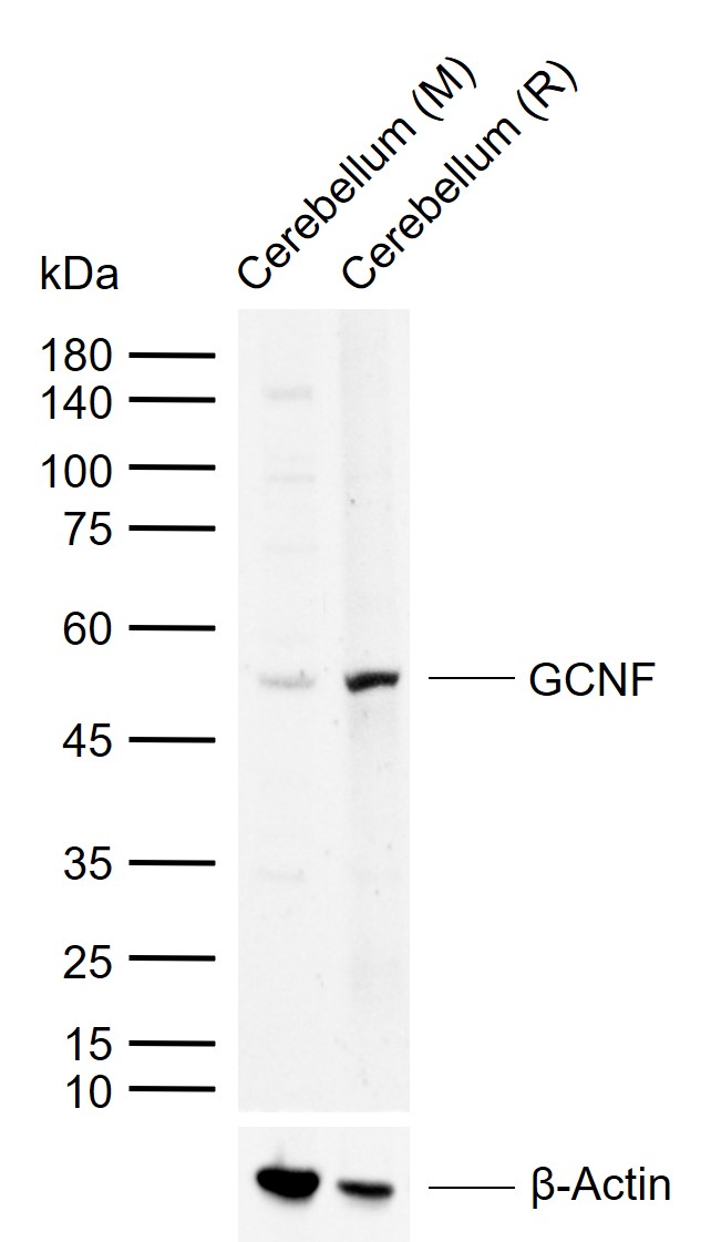 GCNF Rabbit pAb(bs-11558R)-50u