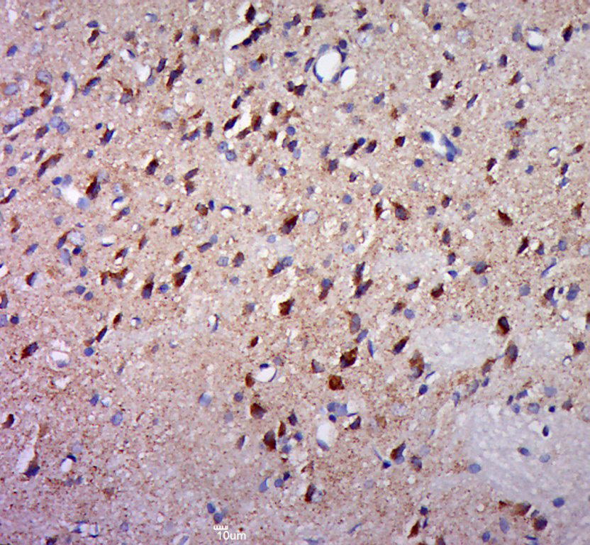 KLHDC10 Rabbit pAb(bs-16757R)-