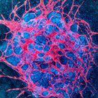 血管化肿瘤类器官-免疫细胞共培养模型