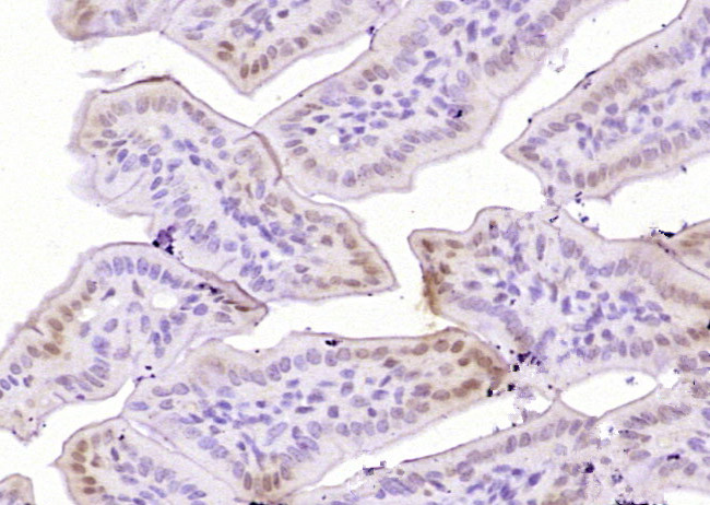 phospho-Bcl-xL (Thr115) Rabbit