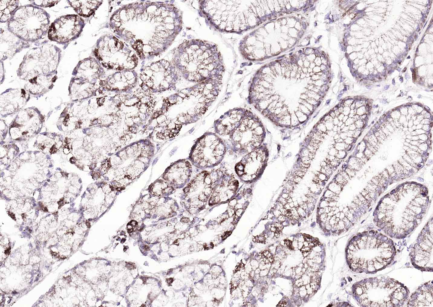 ATP7B Rabbit pAb(bs-1718R)-50u