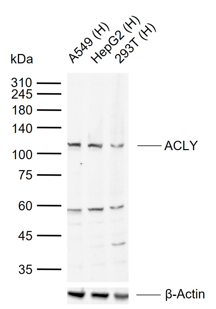 ACLY Rabbit pAb(bs-3929R)-50ul