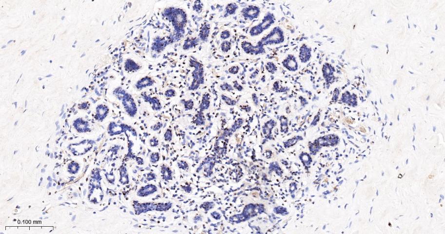 KDM4B Recombinant Rabbit mAb(b