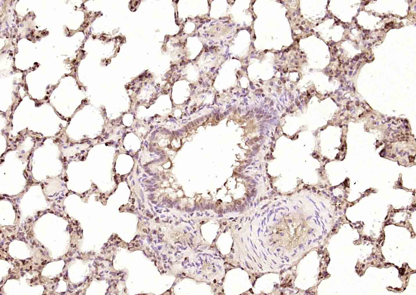 DAP1 Rabbit pAb(bs-6351R)-50ul