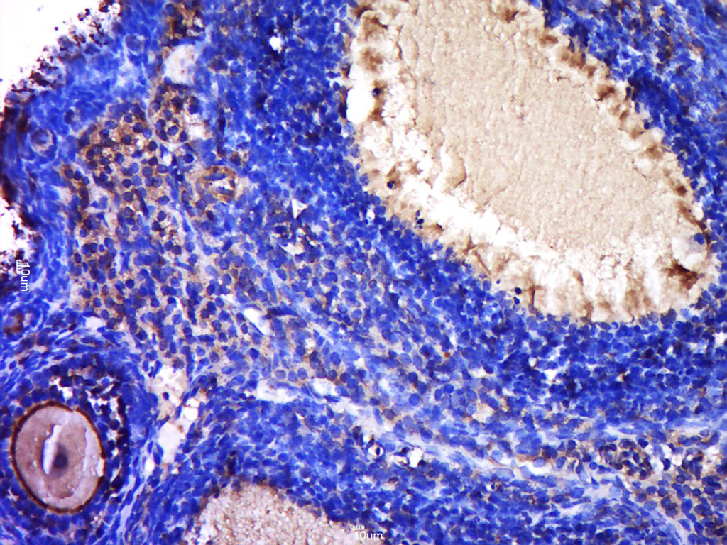 ZP2 Rabbit pAb(bs-20812R)-50ul