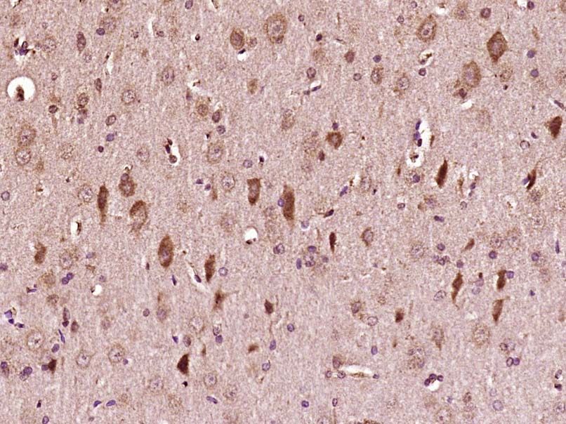 phospho-ATF2 (Ser322) Rabbit p