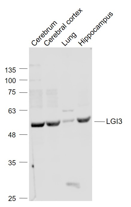 LGI3 Rabbit pAb(bs-11879R)-50u