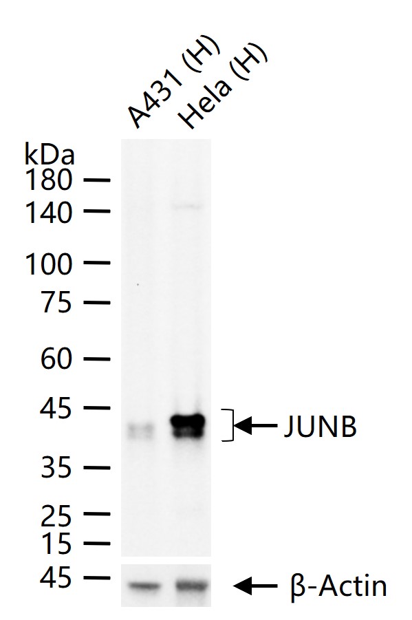 JUNB Recombinant Rabbit mAb(bs