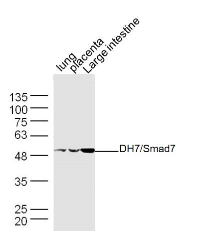 SMAD7 Rabbit pAb(bs-0566R)-50u