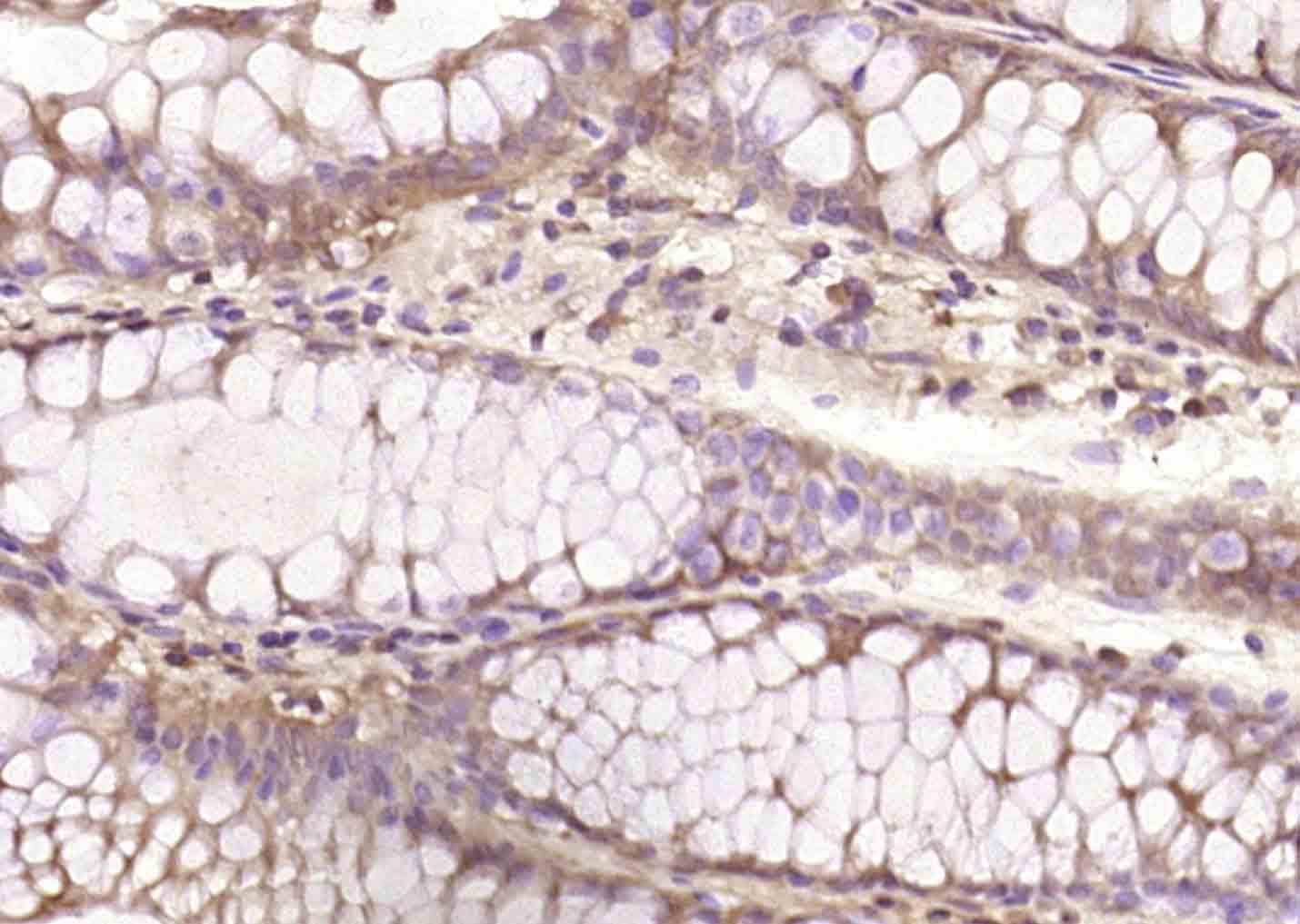 phospho-Bcl-2 (Ser70) Rabbit p