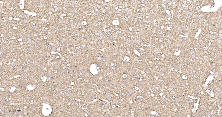 Synaptophysin Recombinant Rabb