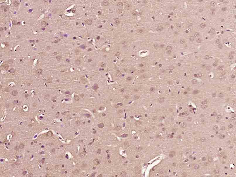 phospho-Tuberin (Ser1418) Rabb