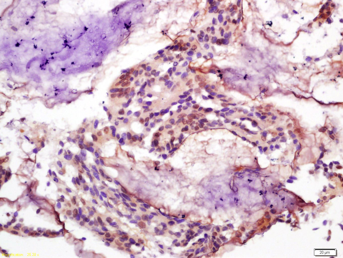 phospho-Smad3 (Ser425) Rabbit 