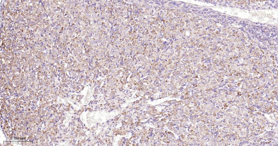 SDHB Recombinant Rabbit mAb(bs