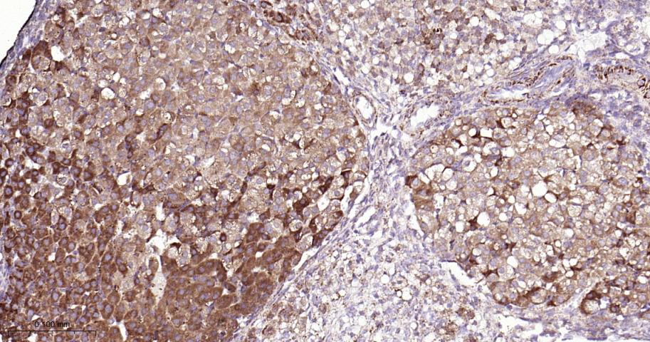 SDHB Recombinant Rabbit mAb(bs