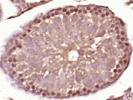 SPDEF Rabbit pAb(bs-1866R)-50u