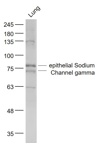 epithelial Sodium Channel gamm