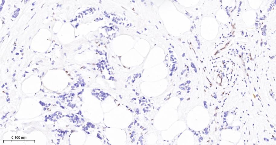 JUNB Recombinant Rabbit mAb(bs