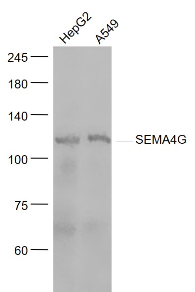 SEMA4G Rabbit pAb(bs-11479R)-5