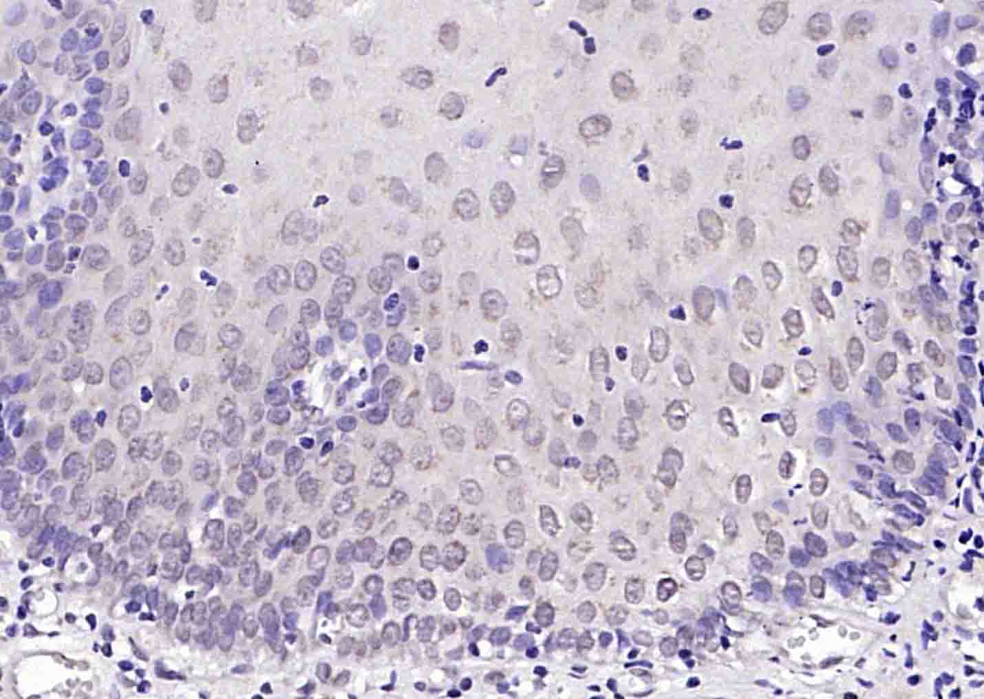 phospho-P53 (Ser392) Rabbit pA