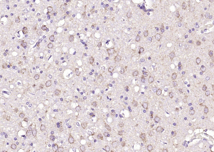 ZNF804A Rabbit pAb(bs-8463R)-5