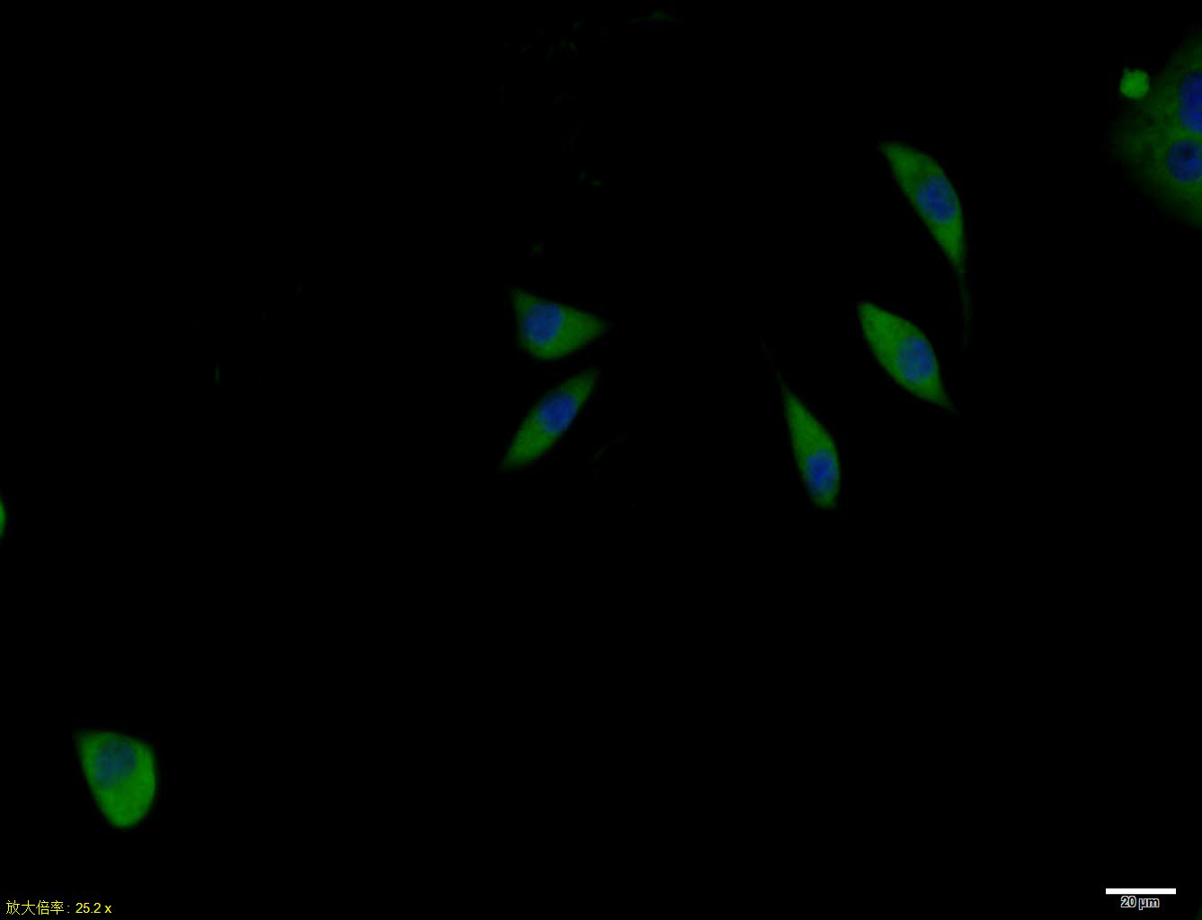 IL-2R gamma Rabbit pAb(bs-2545