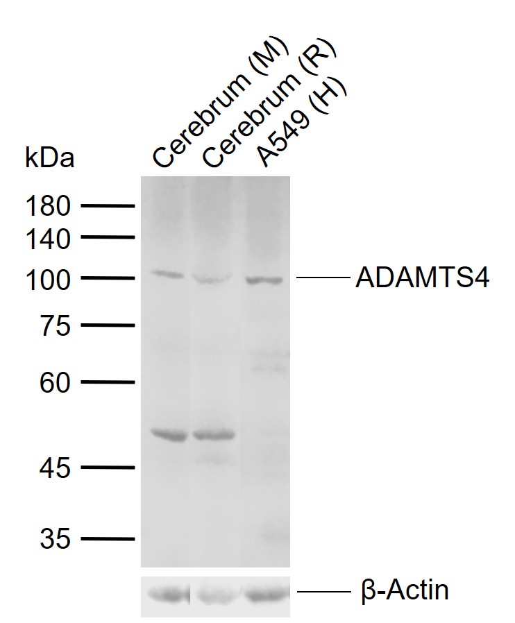 ADAMTS4 Rabbit pAb(bs-4191R)-5