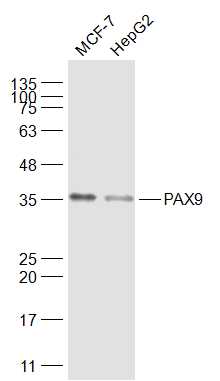 PAX9 Rabbit pAb(bs-1102R)-50ul