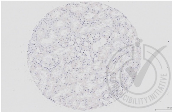 TGF beta Receptor III Rabbit p