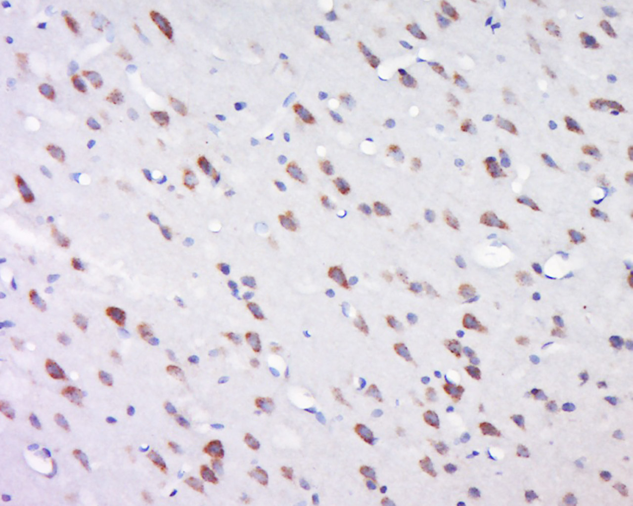 INT11/CPSF3L Rabbit pAb(bs-166