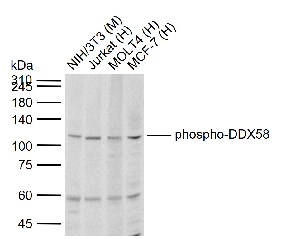 phospho-DDX58 (Thr170) Rabbit 