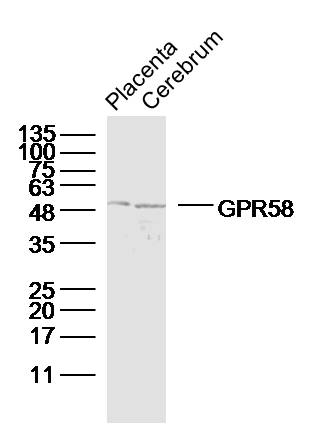 GPR58 Rabbit pAb(bs-13541R)-50