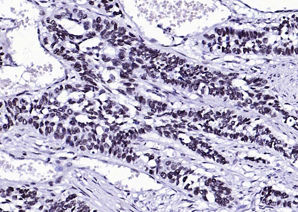 phospho-FGFR1 (Tyr307) Rabbit 