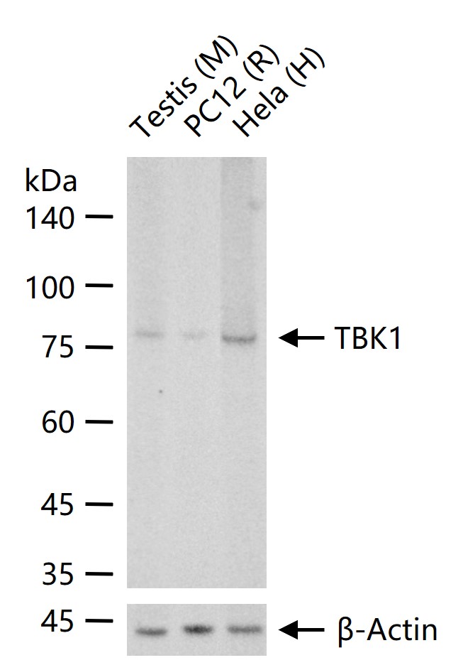 TBK1 Rabbit pAb(bs-7497R)-50ul