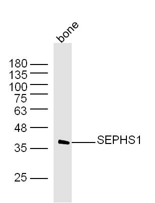 SEPHS1 Rabbit pAb(bs-19627R)-5