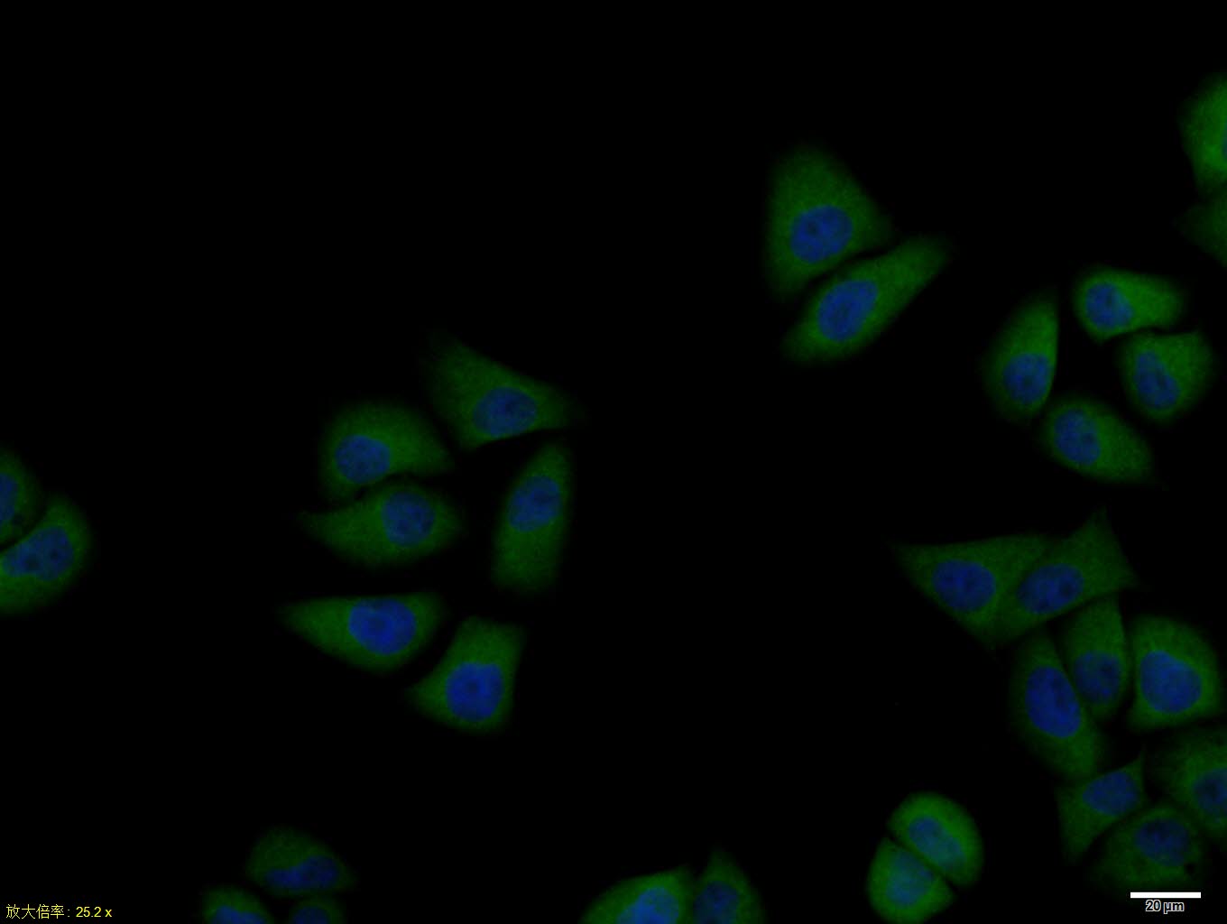 PTPN1 Rabbit pAb(bs-0182R)-50u
