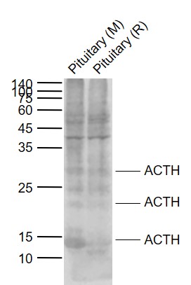 ACTH (7-23) Rabbit pAb(bs-0004